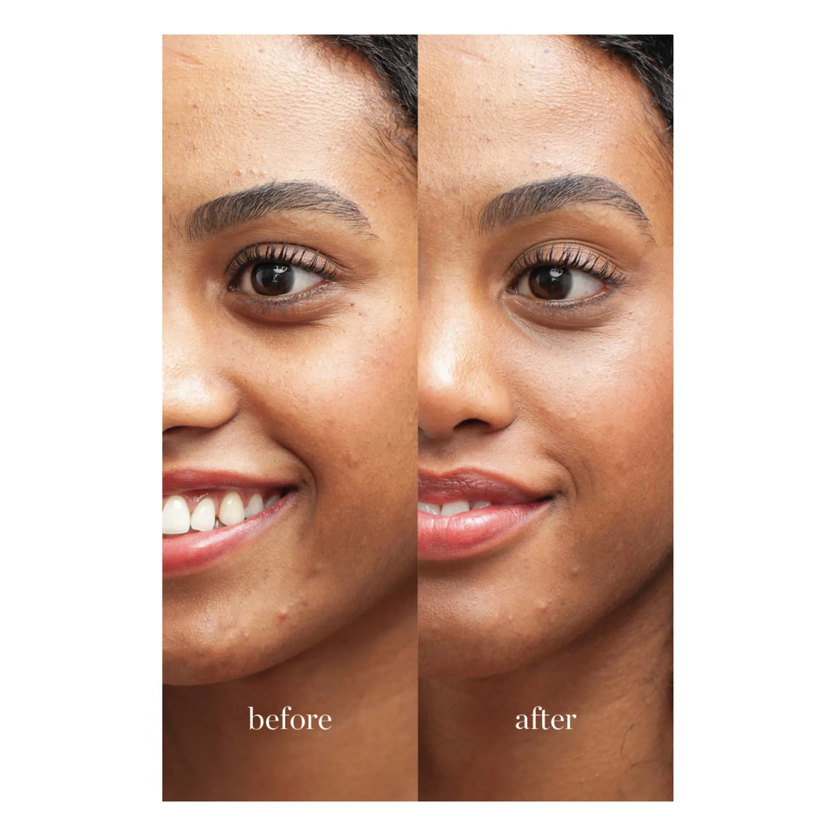 Ere Perez - Lychee Concealer - 10 ml | Seis